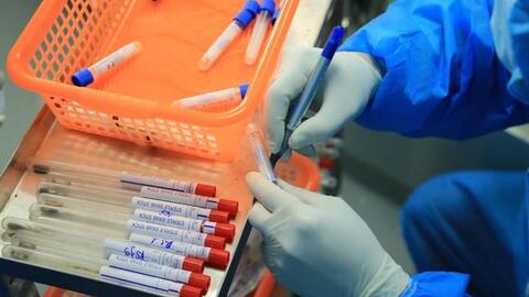 Việt Nam sẽ có vaccine Tả lợn châu Phi vào năm 2022
