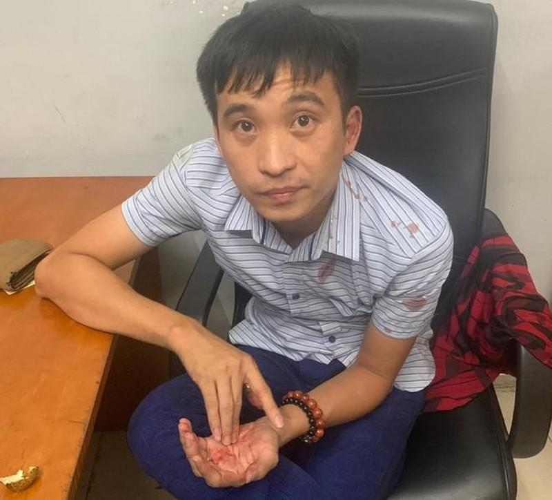 Vụ tông hàng loạt xe tại cây xăng: Sức khỏe các nạn nhân ra sao? - 1